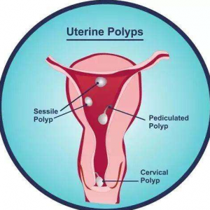 中山做一次试管多少钱？详细价格明细！